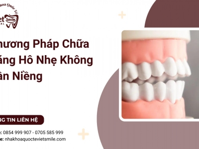 Phương Pháp Chữa Răng Hô Nhẹ Không Cần Niềng