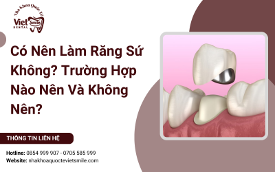 Có Nên Làm Răng Sứ Không? Trường Hợp Nào Nên Và Không Nên?