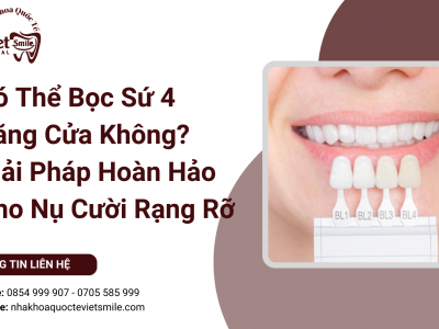 Có Thể Bọc Sứ 4 Răng Cửa Không? Giải Pháp Hoàn Hảo Cho Nụ Cười Rạng Rỡ