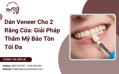 Dán Veneer Cho 2 Răng Cửa: Giải Pháp Thẩm Mỹ Bảo Tồn Tối Đa
