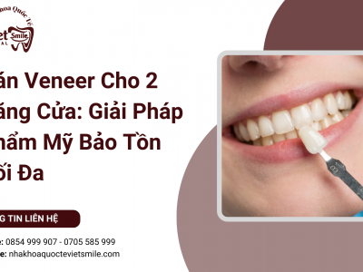 Dán Veneer Cho 2 Răng Cửa: Giải Pháp Thẩm Mỹ Bảo Tồn Tối Đa