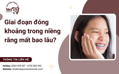 Giai đoạn đóng khoảng trong niềng răng mất bao lâu?