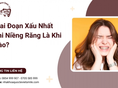 Giai Đoạn Xấu Nhất Khi Niềng Răng Là Khi Nào?