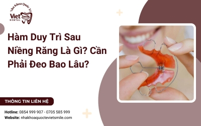 Hàm Duy Trì Sau Niềng Răng Là Gì? Cần Phải Đeo Bao Lâu?