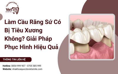 Làm Cầu Răng Sứ Có Bị Tiêu Xương Không? Giải Pháp Phục Hình Hiệu Quả