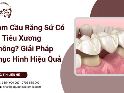Làm Cầu Răng Sứ Có Bị Tiêu Xương Không? Giải Pháp Phục Hình Hiệu Quả