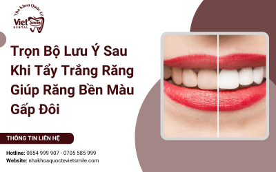 Trọn Bộ Lưu Ý Sau Khi Tẩy Trắng Răng Giúp Răng Bền Màu Gấp Đôi