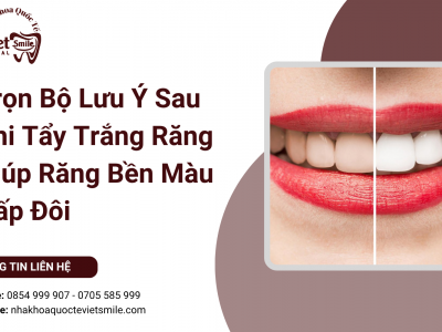 Trọn Bộ Lưu Ý Sau Khi Tẩy Trắng Răng Giúp Răng Bền Màu Gấp Đôi