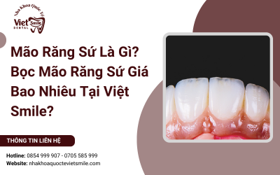 Mão Răng Sứ Là Gì? Bọc Mão Răng Sứ Giá Bao Nhiêu Tại Việt Smile?