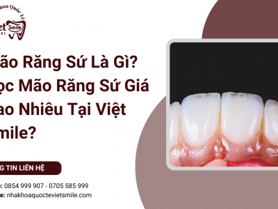 Mão Răng Sứ Là Gì? Bọc Mão Răng Sứ Giá Bao Nhiêu Tại Việt Smile?