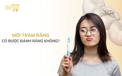 Mới trám răng có được đánh răng không?