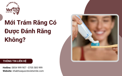 Mới Trám Răng Có Được Đánh Răng Không?