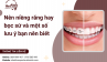 Nên niềng răng hay bọc sứ và một số lưu ý bạn nên biết