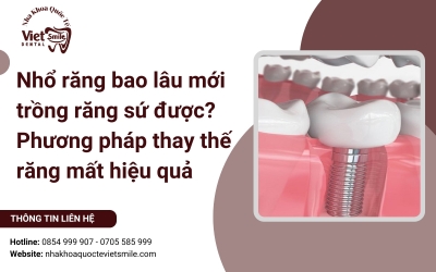Nhổ răng bao lâu mới trồng răng sứ được? Phương pháp thay thế răng mất hiệu quả