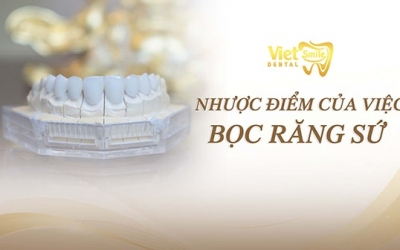 Những nhược điểm của việc bọc răng sứ mà bạn nên biết