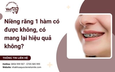 Niềng răng 1 hàm có được không, có mang lại hiệu quả không?