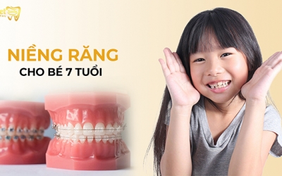 Có nên niềng răng cho bé 7 tuổi không? Những điều bạn cần biết