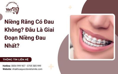 Niềng Răng Có Đau Không? Đâu Là Giai Đoạn Niềng Đau Nhất