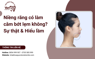 Niềng răng có làm cằm bớt lẹm không? Sự thật & Hiểu lầm
