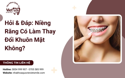 Hỏi & Đáp: Niềng Răng Có Làm Thay Đổi Khuôn Mặt Không?