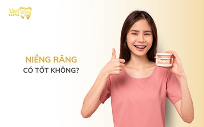 Niềng răng có tốt không? 5 lợi ích của niềng răng có thể bạn chưa biết