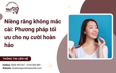 Niềng răng không mắc cài: Phương pháp tối ưu cho nụ cười hoàn hảo