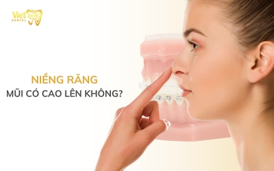 Niềng răng mũi có cao lên không? Sức mạnh thật sự của niềng răng