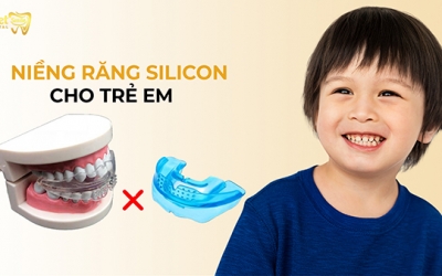 Niềng răng silicon cho trẻ em có thật sự tốt như lời đồn?