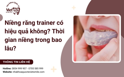 Niềng răng trainer có hiệu quả không? Thời gian niềng trong bao lâu?