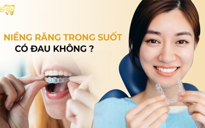 Niềng răng trong suốt có đau không? Cách khắc phục hiệu quả