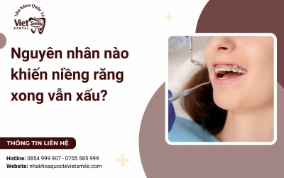 Nguyên nhân nào khiến niềng răng xong vẫn xấu?