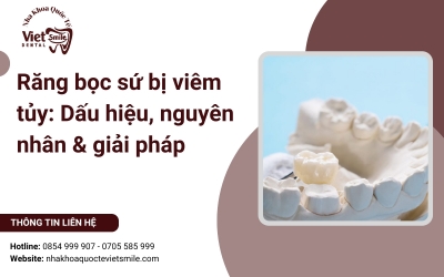 Răng bọc sứ bị viêm tủy: Dấu hiệu, nguyên nhân & giải pháp
