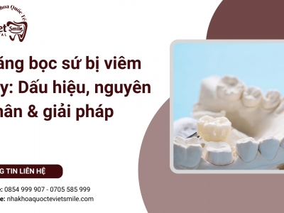 Răng bọc sứ bị viêm tủy: Dấu hiệu, nguyên nhân & giải pháp