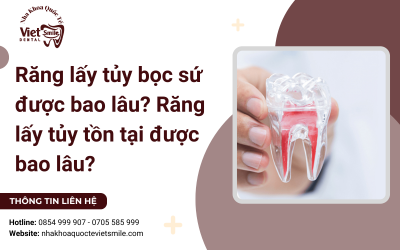 Răng lấy tủy bọc sứ được bao lâu? Răng lấy tủy tồn tại được bao lâu? 