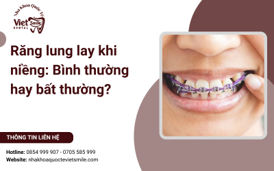 Răng lung lay khi niềng: Bình thường hay bất thường?