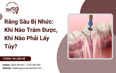 Răng Sâu Bị Nhức: Khi Nào Trám Được, Khi Nào Phải Lấy Tủy?