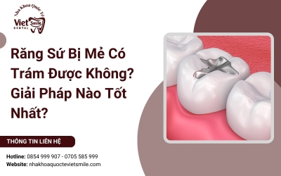 Răng Sứ Bị Mẻ Có Trám Được Không? Giải Pháp Nào Tốt Nhất?
