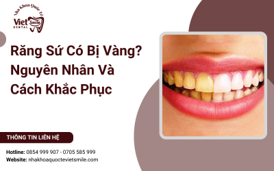 Răng Sứ Có Bị Vàng? Nguyên Nhân Và Cách Khắc Phục Răng Sứ Có Bị Vàng? Nguyên Nhân Và Cách Khắc Phục