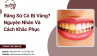 Răng Sứ Có Bị Vàng? Nguyên Nhân Và Cách Khắc Phục Răng Sứ Có Bị Vàng? Nguyên Nhân Và Cách Khắc Phục