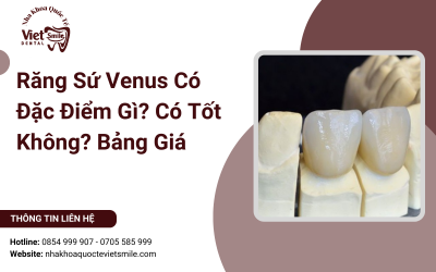 Răng Sứ Venus Có Đặc Điểm Gì? Có Tốt Không? Bảng Giá