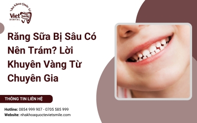 Răng Sữa Bị Sâu Có Nên Trám? Lời Khuyên Vàng Từ Chuyên Gia