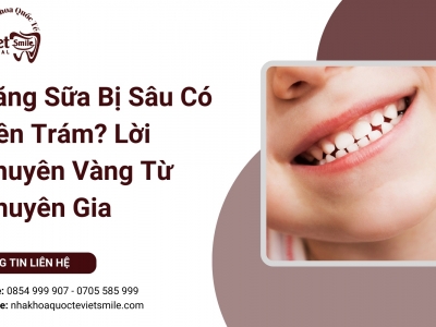 Răng Sữa Bị Sâu Có Nên Trám? Lời Khuyên Vàng Từ Chuyên Gia