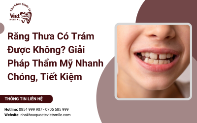 Răng Thưa Có Trám Được Không? Giải Pháp Thẩm Mỹ Nhanh Chóng, Tiết Kiệm
