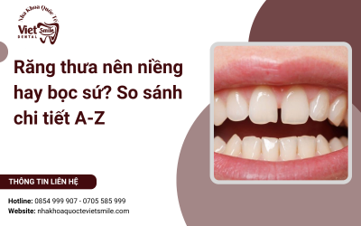 Răng thưa nên niềng hay bọc sứ? So sánh chi tiết A-Z