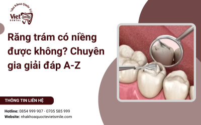Răng trám có niềng được không? Chuyên gia giải đáp A-Z