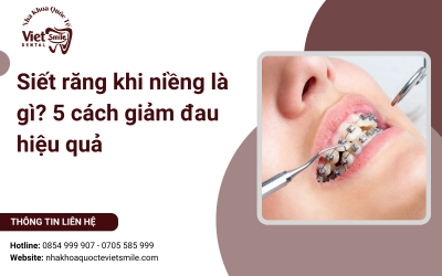 Siết răng khi niềng là gì? 5 cách giảm đau hiệu quả