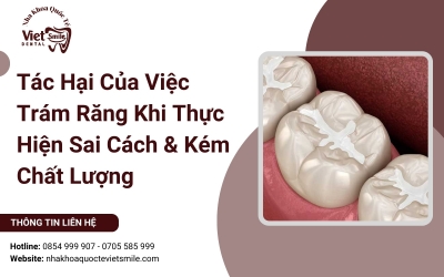 Tác Hại Của Việc Trám Răng Khi Thực Hiện Sai Cách & Kém Chất Lượng