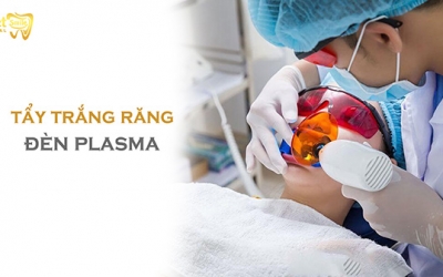 Tẩy trắng răng bằng đèn Plasma có thực sự hiệu quả?