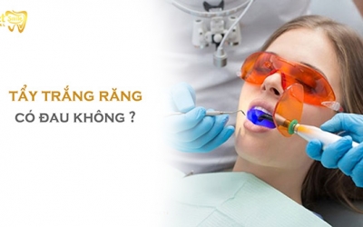 Tẩy trắng răng có đau không? Và làm sao để khắc phục tình trạng này?