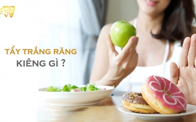 Sau khi tẩy trắng răng kiêng gì và nên ăn gì?